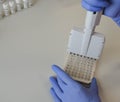 A doctor in blue, disposable, nitrile gloves performs a laboratory analysis by an immunoassay method. a blood test from a vein. Royalty Free Stock Photo