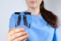 A doctor in a blue uniform shows a picture of a fluorogram of fluorography, an X-ray of the lungs for the prevention and