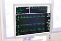 The doctor check heart rate and pulse of patient by running test Royalty Free Stock Photo