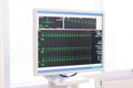 The doctor check heart rate and pulse of patient by running test Royalty Free Stock Photo