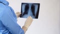 Doctor checking patient lungs x-ray, bronchial disease treatment, pneumonia