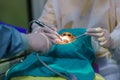 The doctor cleaning the teeth patient with ultrasonic tool Royalty Free Stock Photo