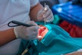 doctor cleaning the teeth patient with ultrasonic tool Royalty Free Stock Photo