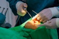 doctor cleaning the teeth patient with ultrasonic tool Royalty Free Stock Photo