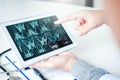 Doctor consulting with patient presenting x-ray film results on digital tablet tablet sitting at table Royalty Free Stock Photo