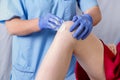 Doctor cosmetician makes the procedure shugaring sugar paste on the right knee to a young woman