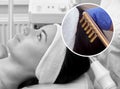 The doctor-cosmetologist makes the procedure Microcurrent therapy On the hair of a beautiful, young woman in a beauty salon. Royalty Free Stock Photo