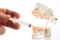 Dental anesthesia concept, close-up