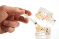 Dental anesthesia concept, close-up