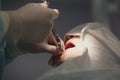 Doctor dentist performs a procedure anesthesia before stomatology surgery