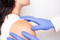 Doctor dermatologist conducts medical examination of problem skin on the patient`s shoulder, pigment spots on the skin, melanin