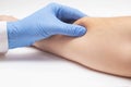Doctor dermatologist examines the subcutaneous wen on the patient`s arm, close-up. Skin cancer, malignancy disease concept