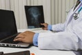 Doctor diagnose and analyze on x-ray film of patient Royalty Free Stock Photo