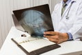 Doctor diagnose and analyze on x-ray film of patient Royalty Free Stock Photo