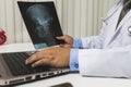 Doctor diagnose and analyze on x-ray film of patient Royalty Free Stock Photo