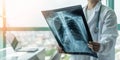 Doctor diagnosing patientÃ¢â¬â¢s health on asthma, lung disease, COVID-19 or bone cancer illness with radiological chest x-ray film Royalty Free Stock Photo