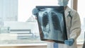 Doctor diagnosing patientÃ¢â¬â¢s health on asthma, lung disease, COVID-19 or bone cancer illness with radiological chest x-ray film