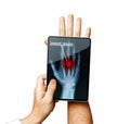 Doctor With Digital Tablet Scans Patient Hand, Modern X-Ray Technology In Medicine And Healthcare Concept Royalty Free Stock Photo