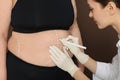 Doctor drawing marks on obese woman`s body against brown background, closeup. Weight loss surgery