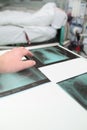Doctor evaluates the dynamics of the patient`s disease by examining a series of X-rays