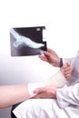 Doctor exam one X-ray picture of sprained foot Royalty Free Stock Photo