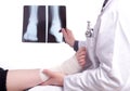 Doctor exam one X-ray picture of sprained foot Royalty Free Stock Photo