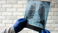 The doctor examines the chest in the picture. X-ray of the lungs in the hands of a doctor against the background Royalty Free Stock Photo