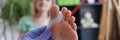 Doctor examines leg with hallux valgus deformity of first toe