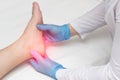 Doctor examines the leg of the woman heel for heel spurs, pain in the foot, plantar fasciitis, osteophyte