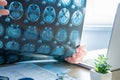 Doctor examines MRI scan of head and brain near computer during work and patient appointment in office. On MRI clearly shows both Royalty Free Stock Photo