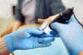 Doctor examines the nail bed and blood vessels of a young woman's fingers through a microscope Royalty Free Stock Photo