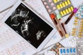 A doctor examines the ultrasound and cardiogram of a pregnant woman in order to prescribe treatments that will preserve