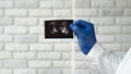 Doctor examines ultrasound images of the prostate gland, pictures of the prostate in the hands of a medical professional Royalty Free Stock Photo