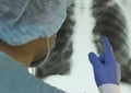 A doctor examines an X-ray of a patient s lung infected with covid-19 coronavirus Royalty Free Stock Photo