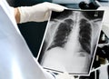 Doctor examining a lung radiography, Doctor looking chest x-ray film. Royalty Free Stock Photo