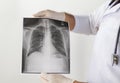 Doctor examining a lung radiography. Royalty Free Stock Photo