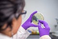 Doctor examining meningococcal bacterial culture plate