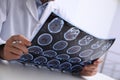 Doctor examining MRI images of patient with multiple sclerosis at table in clinic, closeup