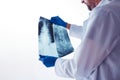 Doctor examining x-ray of the human spine Royalty Free Stock Photo