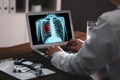 Doctor examining x-ray of patient with lung cancer on laptop in clinic Royalty Free Stock Photo