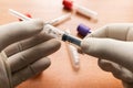 Doctor hand in white glove holding syringe, to get blood sample in laboratory with Plain Clot Activators as a background In India Royalty Free Stock Photo