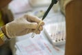 Doctor hand working with blood sample. Health care Royalty Free Stock Photo