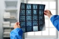 A doctor hands holding spine radiography X-ray