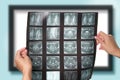 A doctor holding and analyzes spine radiography X-ray