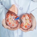 Doctor holding Anatomical kidney Adrenal gland model. disease of Urinary system and Stones, Cancer, world kidney day, Chronic