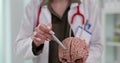 Doctor holding an artificial model of human brain