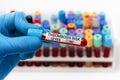 Blood sample test with positive diagnosis of Thrombosis risk in a coagulation test