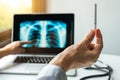 Doctor holding a cigarette and showing x-ray of lungs. Lungs cancer prevention concept Royalty Free Stock Photo