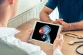 Doctor holding a digital tablet with x-ray of front of the skull head of the patient. Brain cancer headache or trauma concept Royalty Free Stock Photo