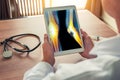 Doctor holding a digital tablet with x-ray of legs with pain. Stethoscope and syringe on the desk